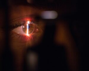 person with lighted cigarette in mouth